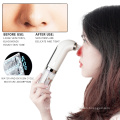 Professional 65Kpa Strong Power Vacuum Suction Microbubble Pore Cleaner Water Cycle Blackhead Remover